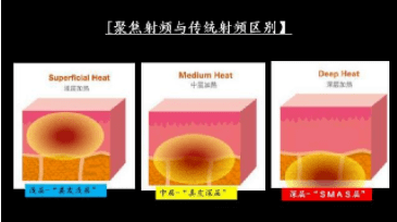苹果6韩版需要激活吗吗:不做大冤种~热拉提有副作用吗，热拉提的副作用和危害！